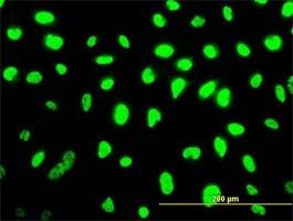Anti-SMU1 Antibody