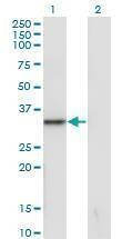Anti-SNAI1 Antibody