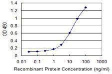 Anti-SNAI1 Antibody