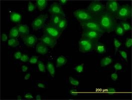 Anti-SNAI2 Antibody