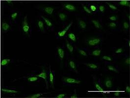 Anti-SNAPC4 Antibody