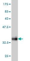 Anti-SNAPC5 Antibody