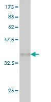 Anti-SNCAIP Antibody
