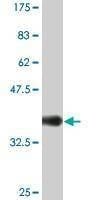 Anti-SNCG Antibody