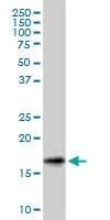 Anti-SNCG Antibody