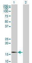 Anti-SNCG Antibody