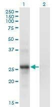 Anti-SNF8 Antibody