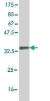 Anti-SOX12 Antibody