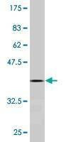 Anti-SOX18 Antibody