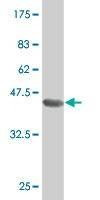 Anti-SOX30 Antibody