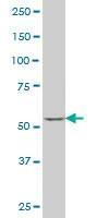 Anti-SOX30 Antibody