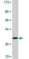 Anti-SOX8 Antibody