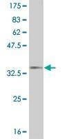 Anti-SP1 Antibody