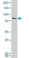 Anti-SP1 Antibody