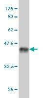 Anti-SP100 Antibody