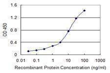 Anti-SP100 Antibody