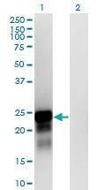 Anti-SPANXN3 Antibody