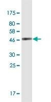 Anti-SPANXN3 Antibody