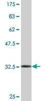 Anti-SPOP Antibody