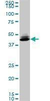 Anti-SPP1 Antibody