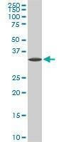 Anti-SPP1 Antibody