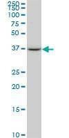 Anti-SPP1 Antibody