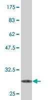 Anti-SRD5A2 Antibody