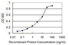 Anti-SRD5A2 Antibody