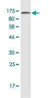 Anti-ACTN4 Antibody
