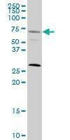 Anti-SRF Antibody