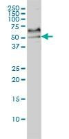 Anti-SRF Antibody