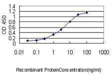 Anti-SRF Antibody