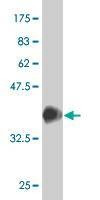 Anti-SRF Antibody