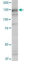 Anti-SRGAP1 Antibody