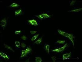 Anti-SRPK1 Antibody