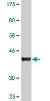 Anti-SRPK1 Antibody