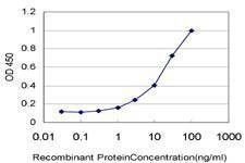 Anti-SSH3 Antibody