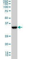 Anti-SSR1 Antibody