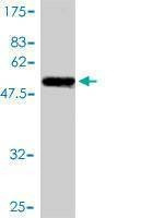 Anti-SSR1 Antibody