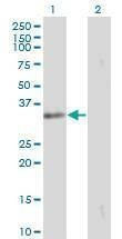 Anti-SSR1 Antibody