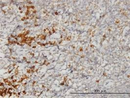 Anti-SSR1 Antibody