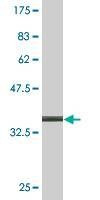 Anti-ACTRT2 Antibody