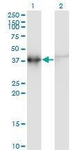 Anti-ACTRT2 Antibody