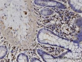 Anti-ACTRT2 Antibody