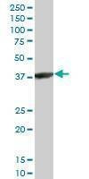 Anti-ACTRT2 Antibody