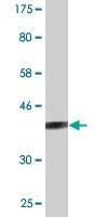 Anti-STAT6 Antibody