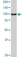 Anti-STAT6 Antibody