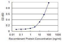 Anti-STIM1 Antibody