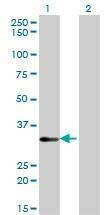 Anti-STK16 Antibody