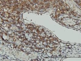 Anti-STK16 Antibody